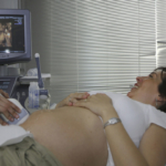 ultrasound-woman2160