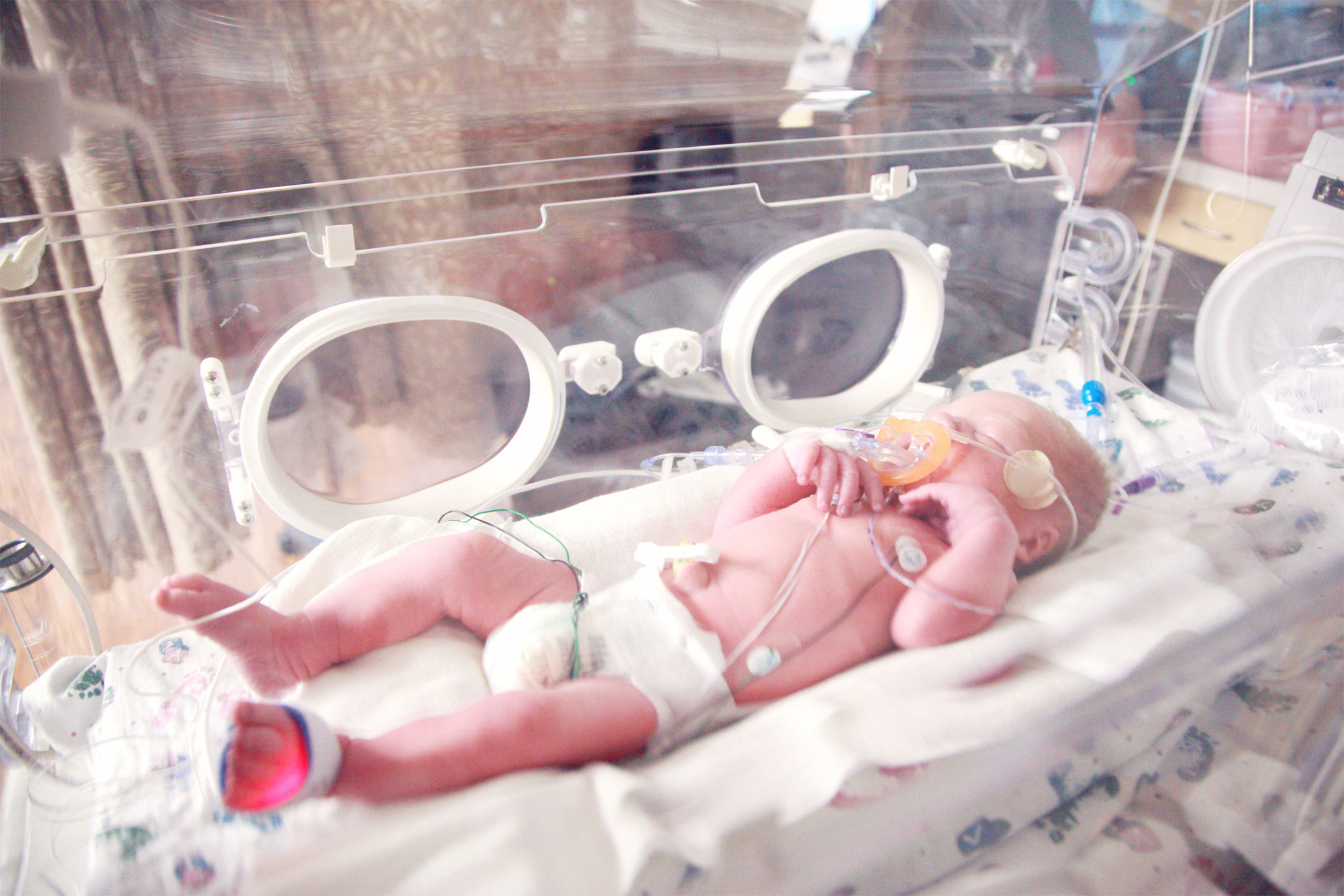 premmie-baby-NICU2160