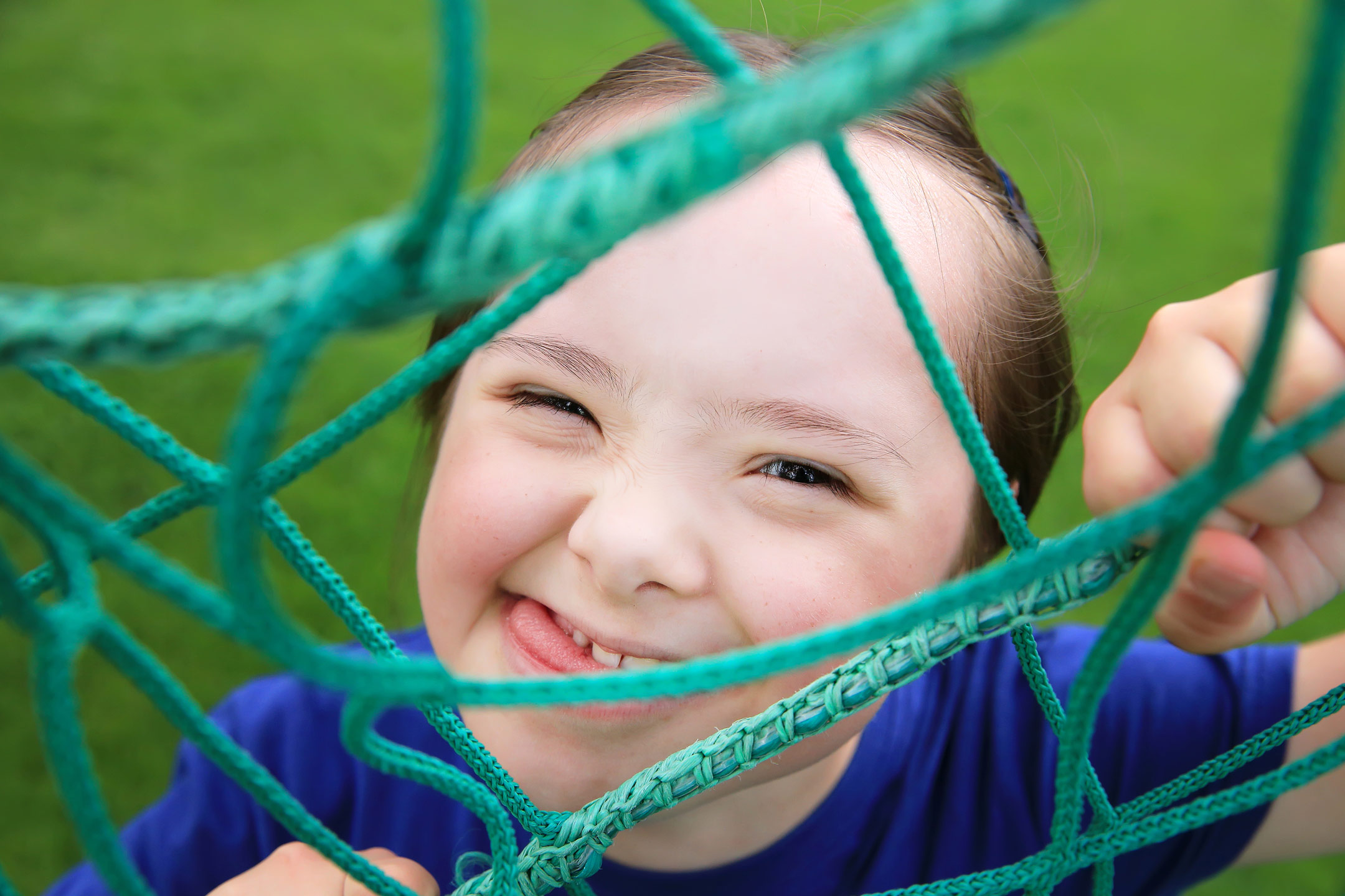 down-syndrome-girl-smiling2160
